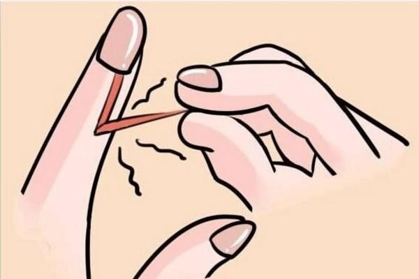 基础油一样有神奇的功效解决倒戗刺的问题