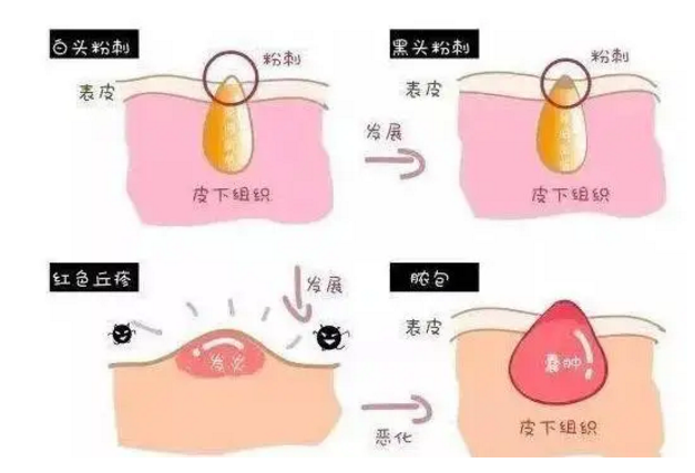 微信图片_20200503203426.png
