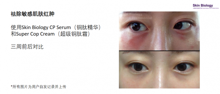 蓝铜胜肽功效1.png