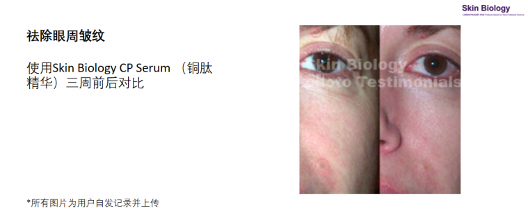 蓝铜胜肽功效2.png