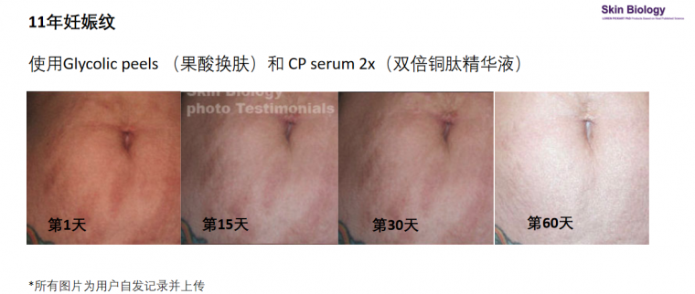 蓝铜胜肽功效3.png