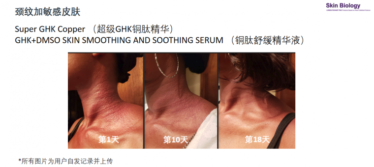 蓝铜胜肽功效4.png
