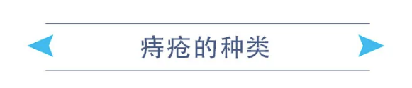 痔疮的种类.png