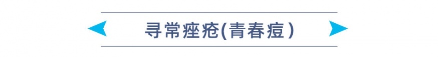 寻常痤疮 标题.jpg