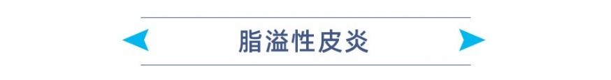 脂溢性皮炎 标题.jpg