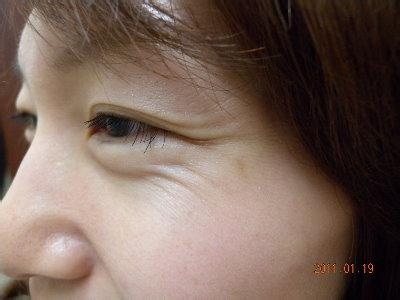 精油去鱼尾纹、法令纹