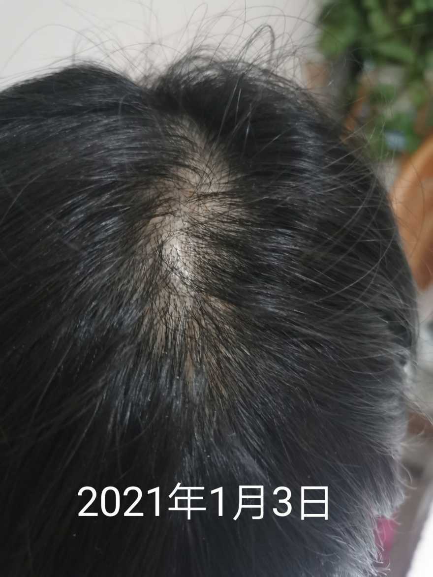 1646405014335415.jpeg