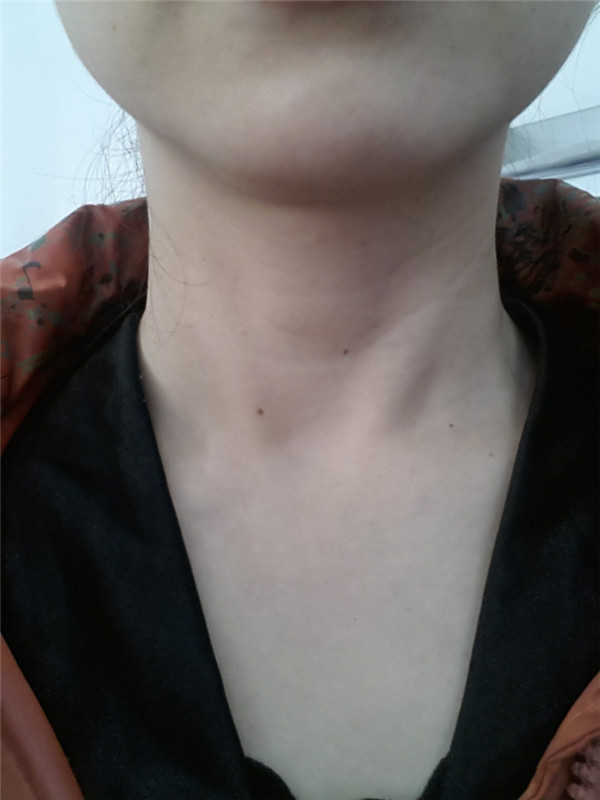 20141226_093446.jpg